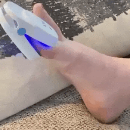 Easy Home Toenail Fungus Removal Laser Device