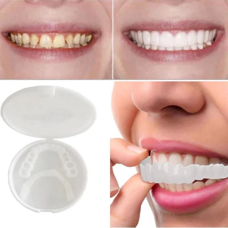 SnapFit | Innovative Customizable Dental Veneers for Perfect Smile 3