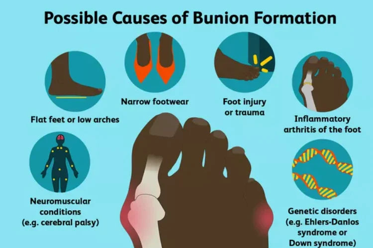 Comfortable Bunion Support for Foot Pain Relief