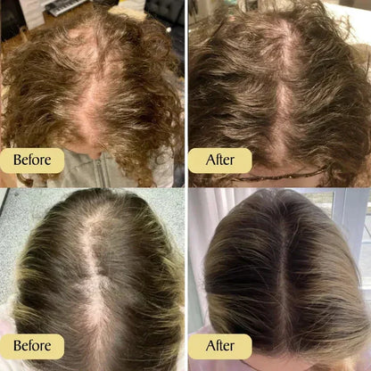 Pure Hair Regrowth Essential Oil