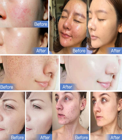 Colorful LED Skin Care Face Light