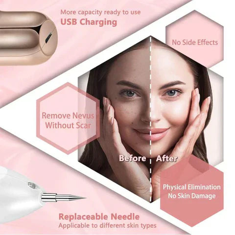 Professional Skin Tag Remover Pen With Adjustable Intensity
