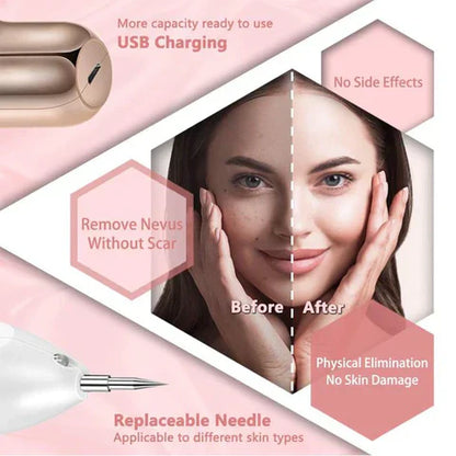 Professional Skin Tag Remover Pen 9 Adjustable Levels
