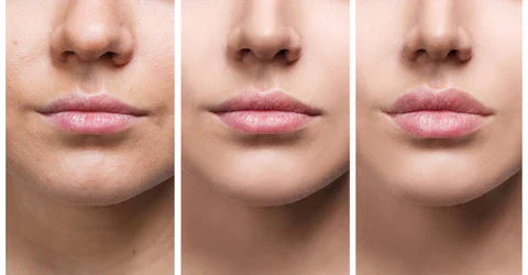 Natural Lip Enhancer Serum | Plump Lips At Home