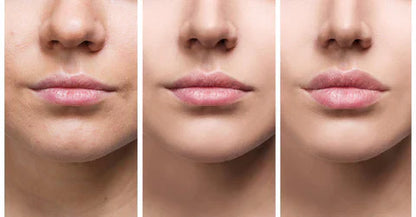 Natural Lip Enhancer Serum | Plump Lips At Home
