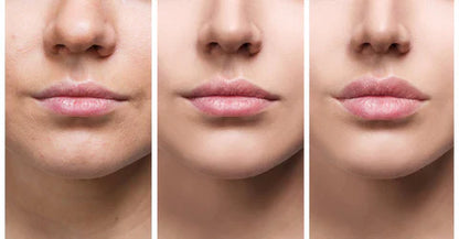 Plumping Lip Serum for Fuller Lips Fast