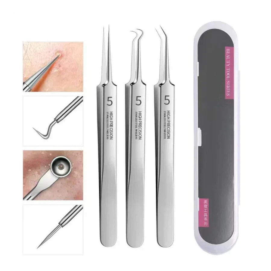 Easy Blackhead Remover Kit, 3 Piece Set - Lusomart