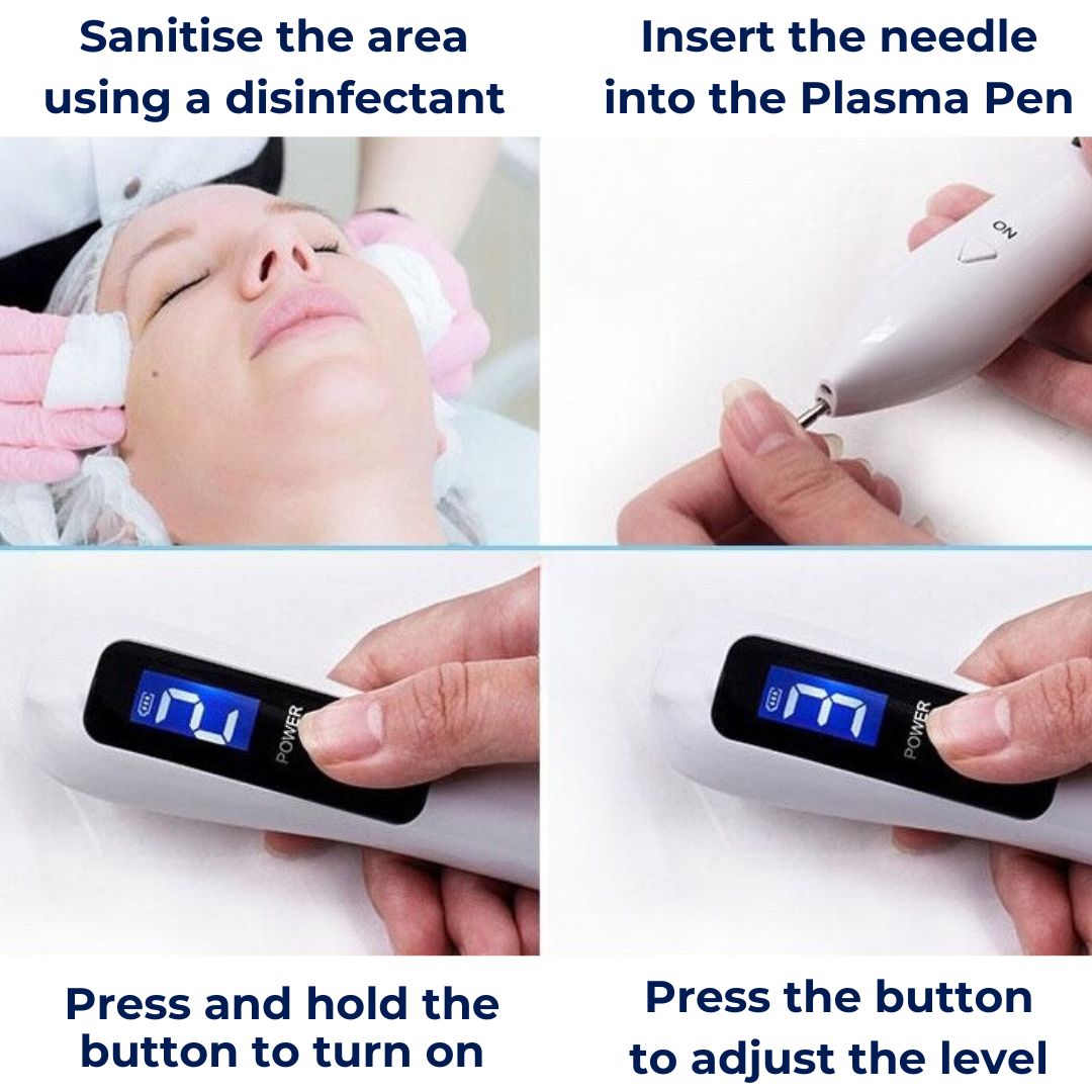 Professional Skin Removal Laser Pen Tool