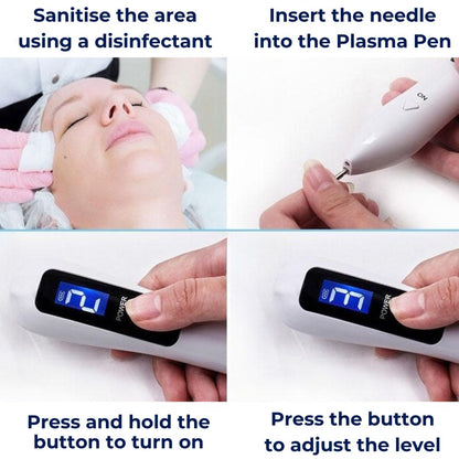 Professional Skin Removal Laser Pen Tool