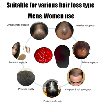 Advanced Hair Regrowth Laser Cap Device
