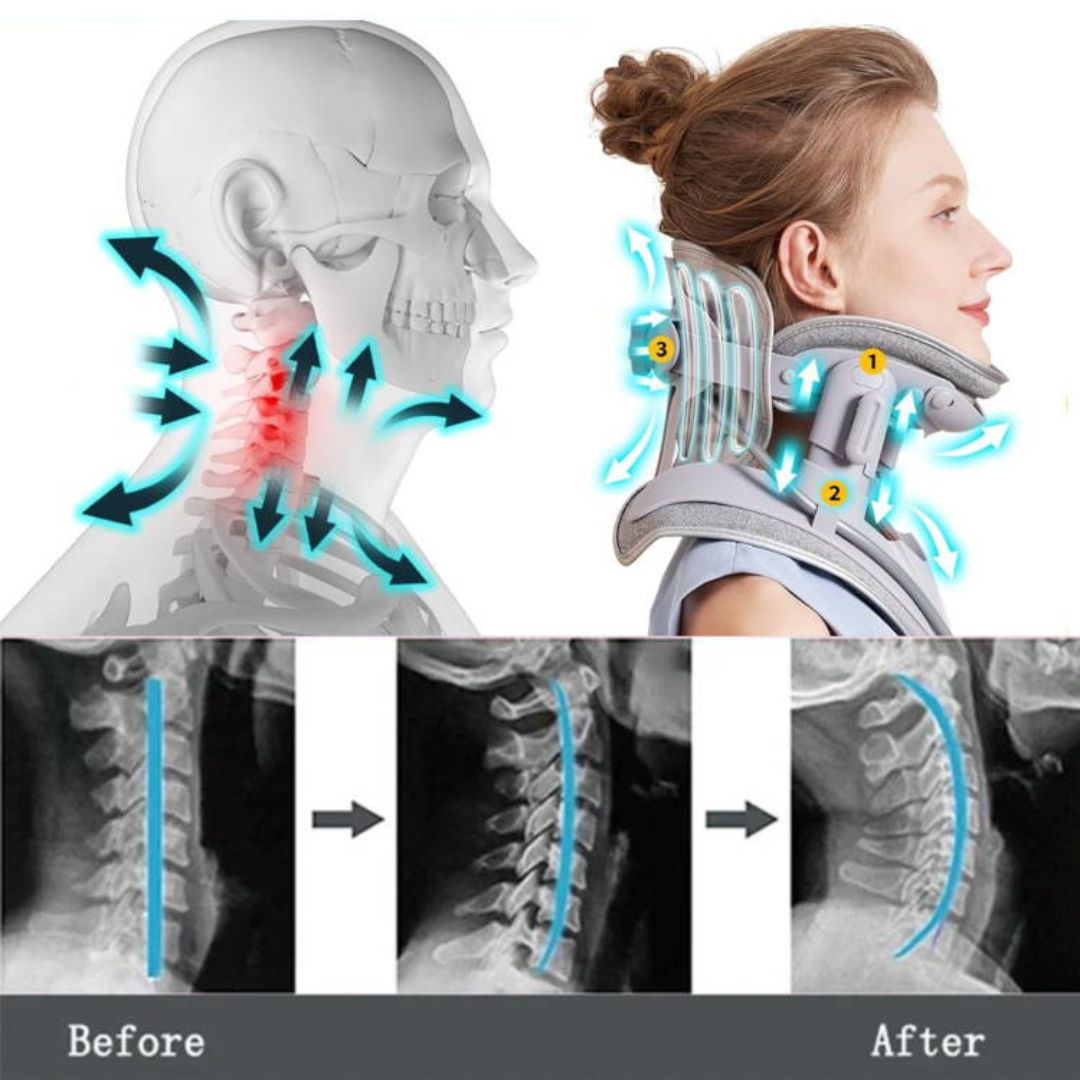 Comfortable Cervical Traction Collar For Neck Pain Relief