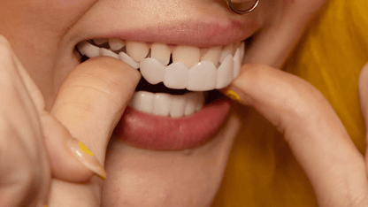 Easy Fit Smile Veneers for Top and Bottom Teeth