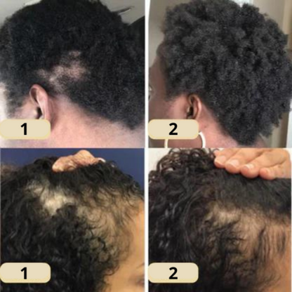 Natural Hair Growth Essential Oil Serum