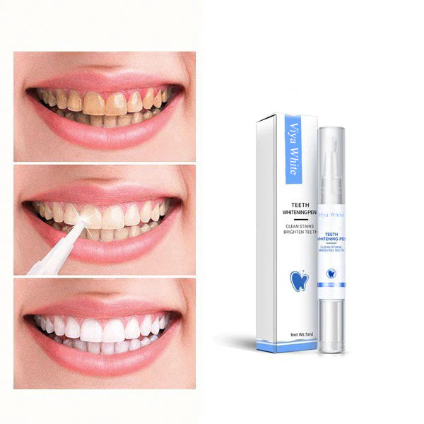 Fast At Home Teeth Whitening Kit - Lusomart