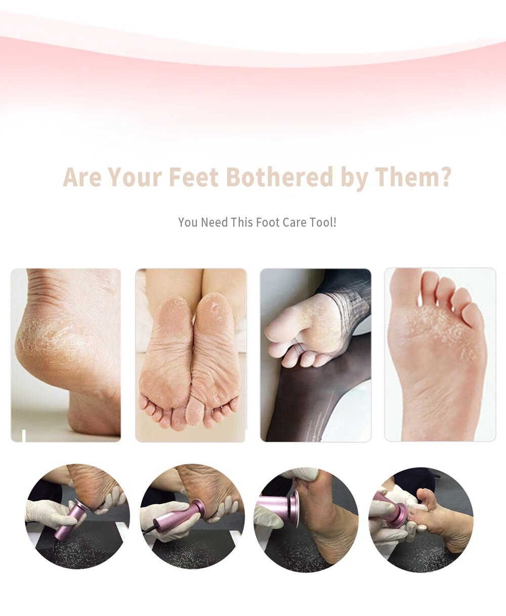 Easy To Use Foot And Hand Callus Shaver