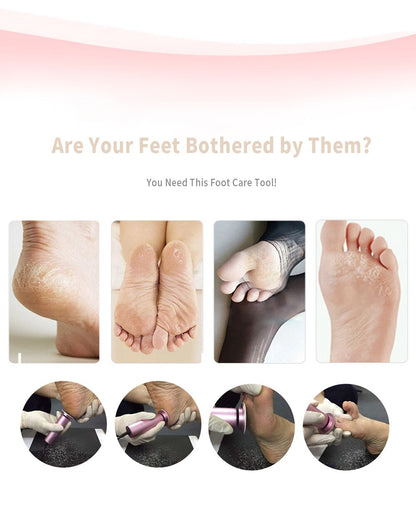Easy To Use Foot And Hand Callus Shaver