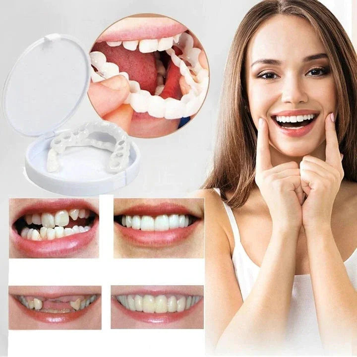 Easy Fit Smile Veneers for Top and Bottom Teeth - Lusomart
