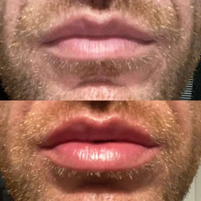 Natural Lip Enhancer Serum | Plump Lips At Home