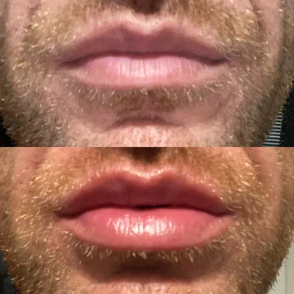 Natural Lip Enhancer Serum | Plump Lips At Home