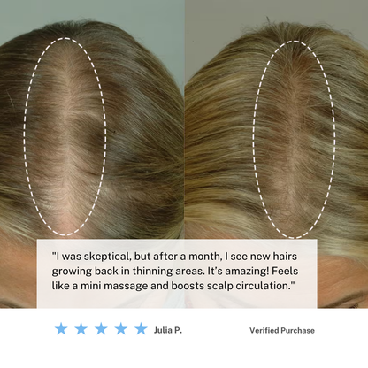 Portable Hair Massager Brush for Relaxing Scalp Care