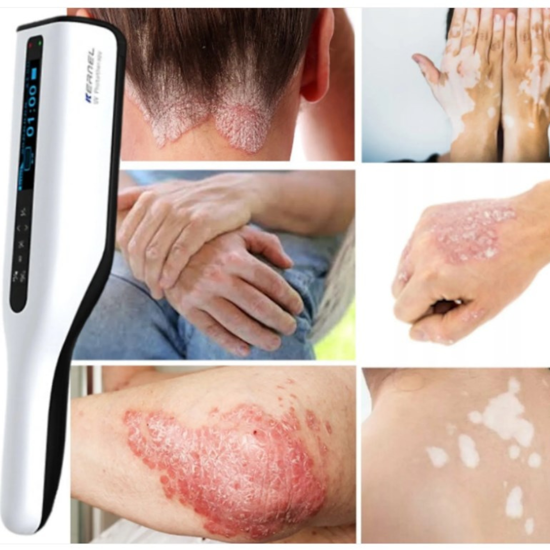 Compact UVB Light Therapy Lamp for Skin Treatment