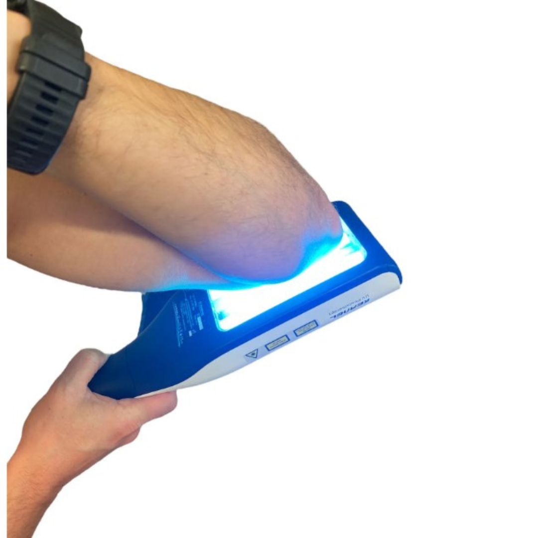 Compact UVB Light Therapy Lamp for Skin Treatment