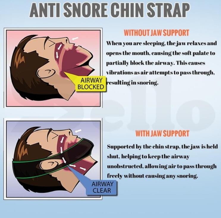 Anti Snore Chin Strap Sleep Aid Belt, Black