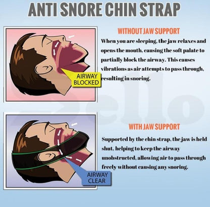 Anti Snore Chin Strap Sleep Aid Belt, Black