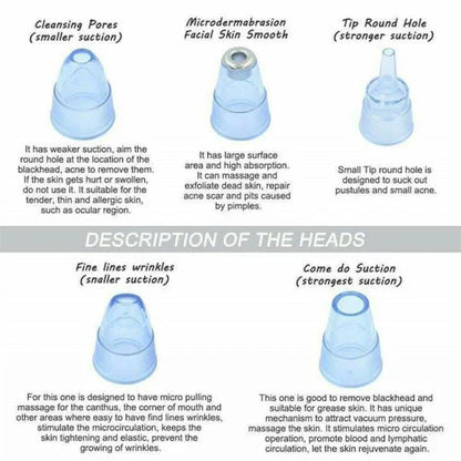 Effective Blackhead Remover Vacuum Cleaner