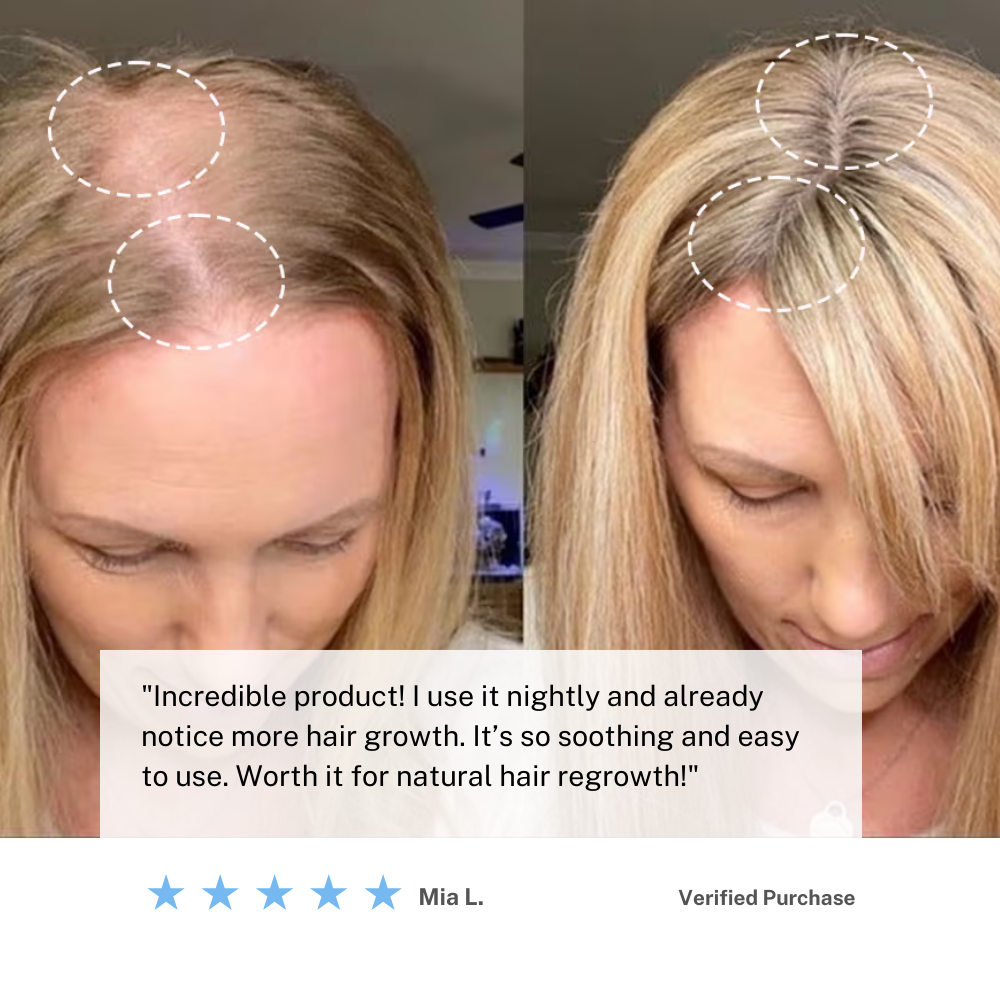 Portable Hair Massager Brush for Relaxing Scalp Care