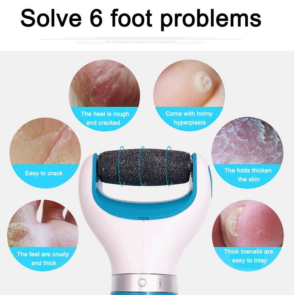 Electric Foot File Callus Shaver for Home Pedicure