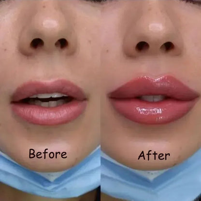 Plumping Lip Serum for Fuller Lips Fast