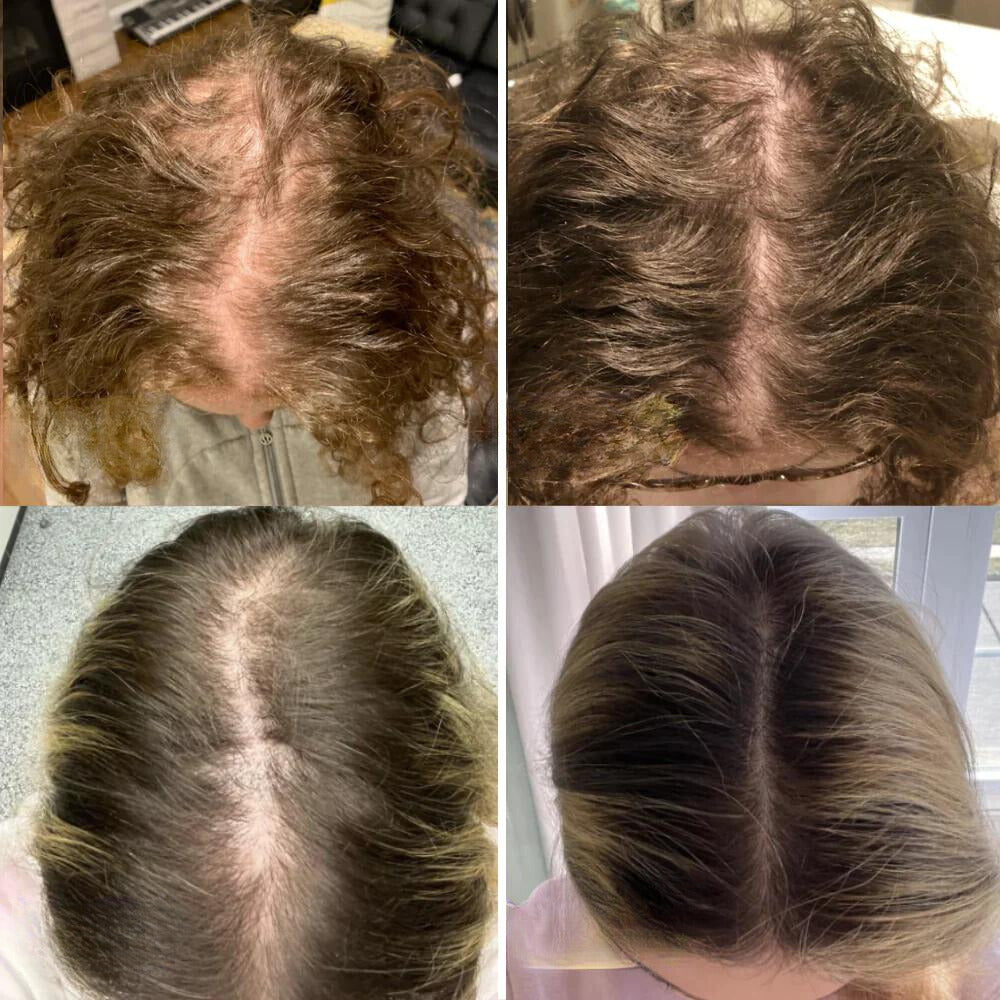 Natural Hair Growth Essential Oil Serum