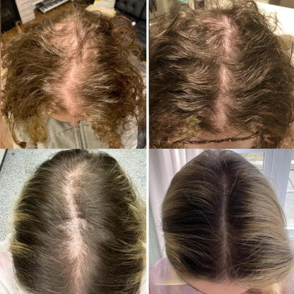 Natural Hair Growth Essential Oil Serum