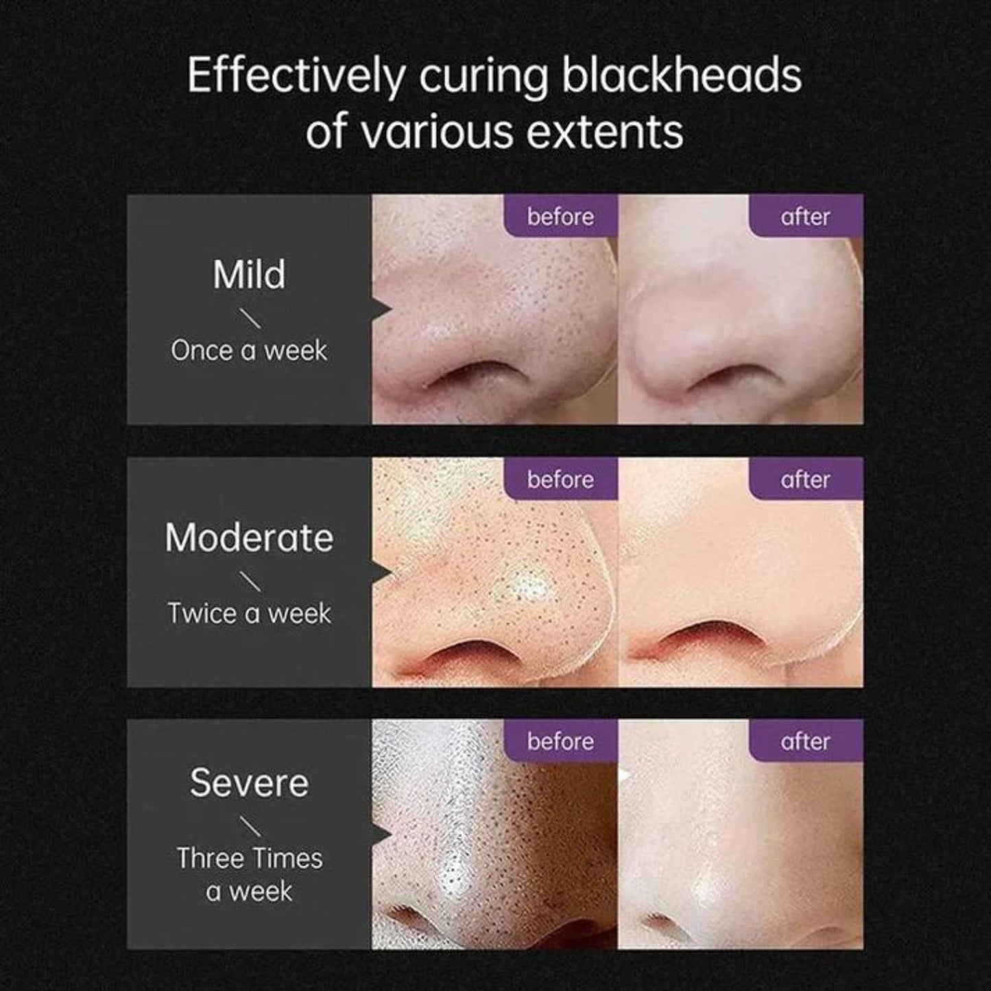 Deep Cleansing Face Mask
