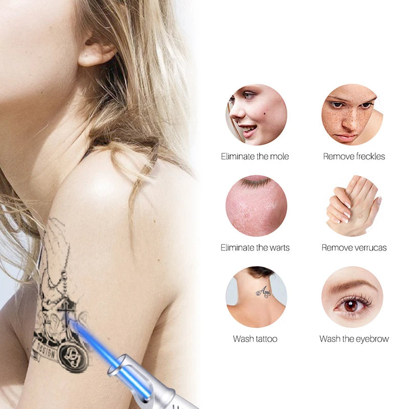 Professional Skin Laser Removal Pen For Home Use
