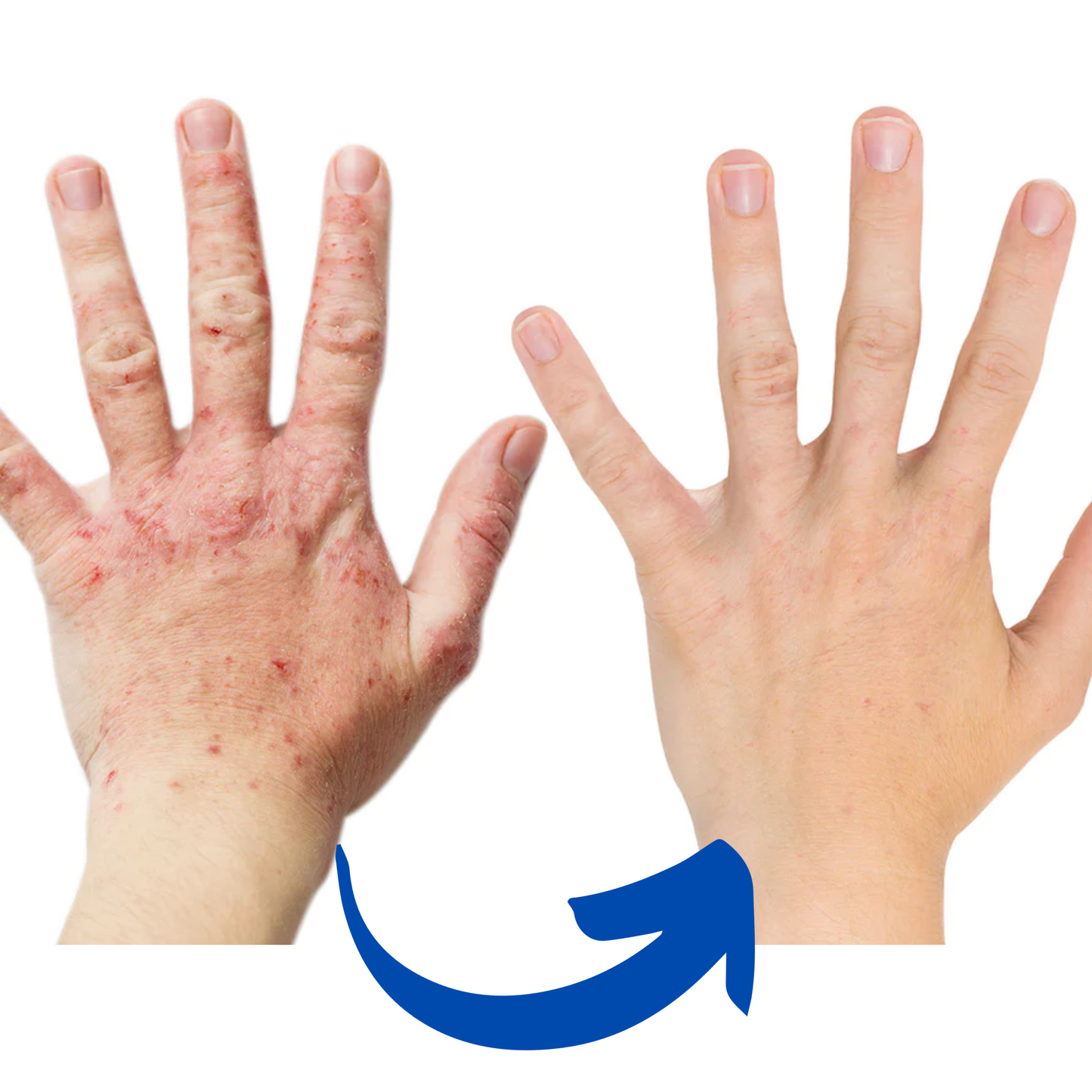 Warm Heat Therapy Arthritis Gloves for Hands