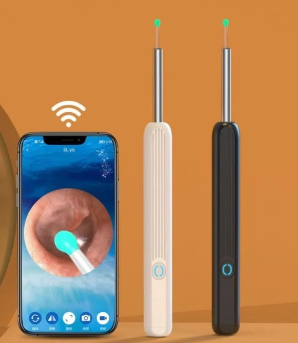 Advanced Wireless Ear Wax Remover