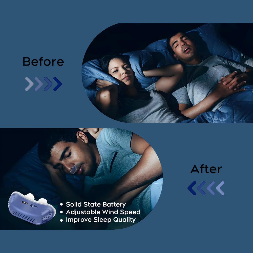 Sleep Apnea Nose Aid Silicone Breathing Helper