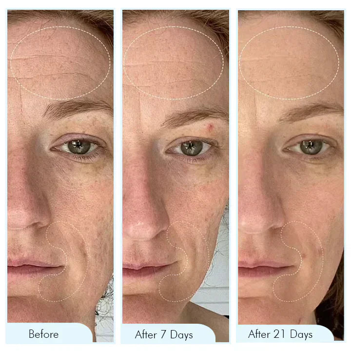 Natural Collagen Face Mask for Hydrated Skin