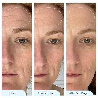 Natural Collagen Face Mask for Hydrated Skin