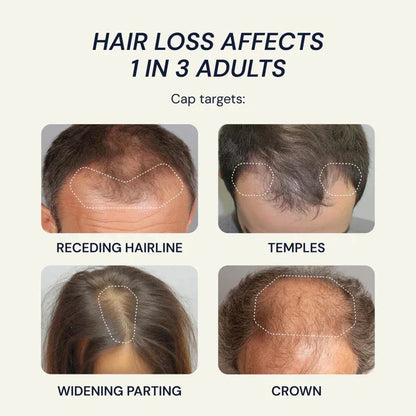 Low Level Laser Hair Regrowth Treatment Cap