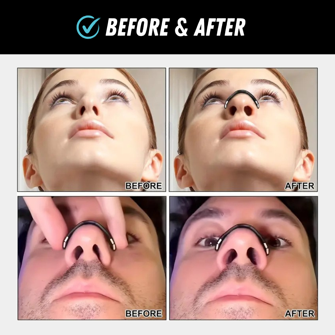 BreatheEasy | Comfortable Magnetic Nasal Strips for Snoring Relief 6