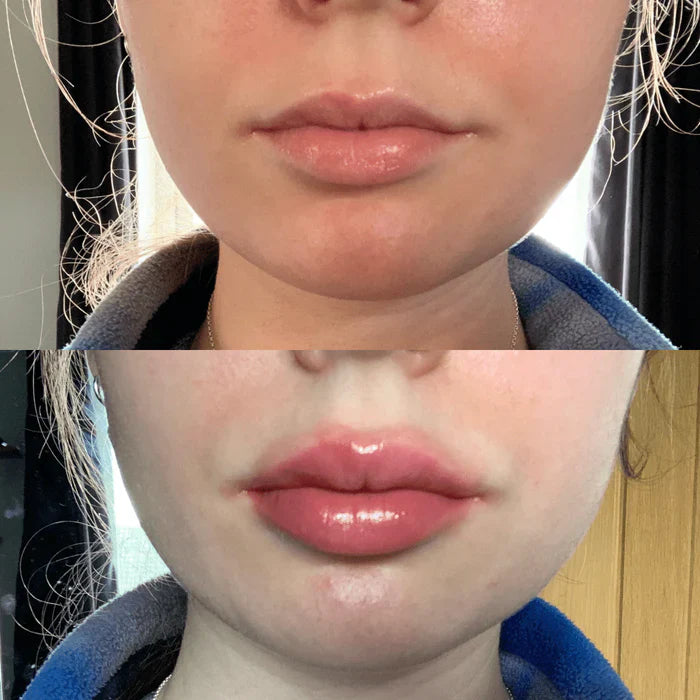 Plumping Lip Serum for Fuller Lips Fast
