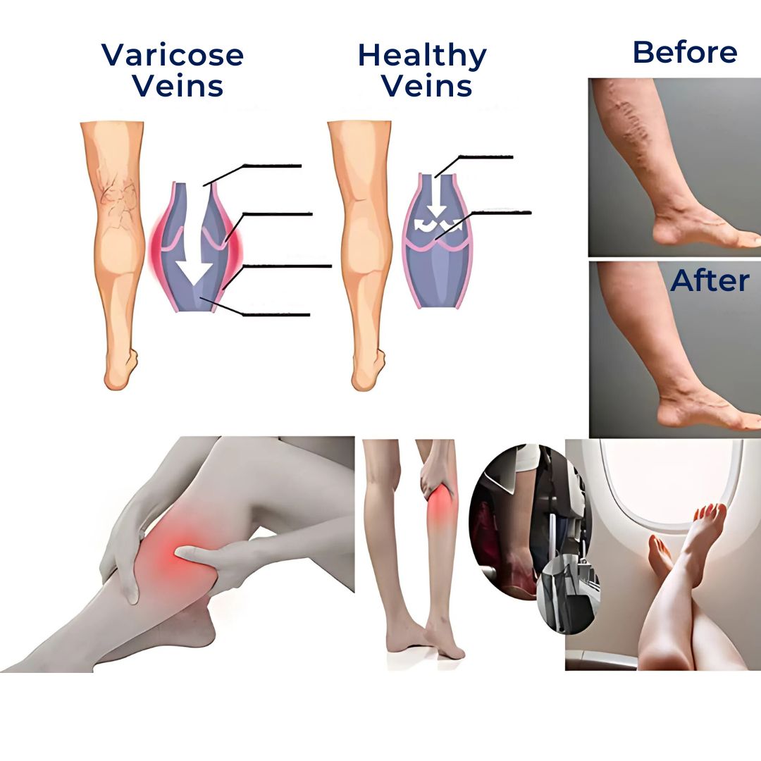 Performance Compression Socks For Improved Circulation
