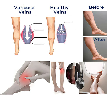 Performance Compression Socks For Improved Circulation