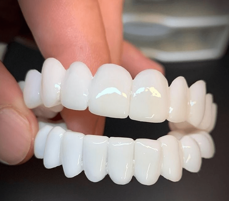 Comfortable Custom Dental Partial Dentures - Lusomart