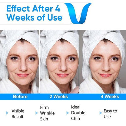 Double Chin Massager - Electric V-Face Shaping Massage Face Lifting Slim Double Chin Removal Machine 7