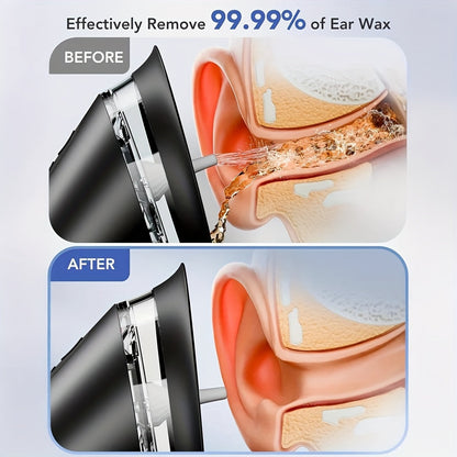 Effective Ear Cleaner Kit USB Rechargeable Water Irrigator