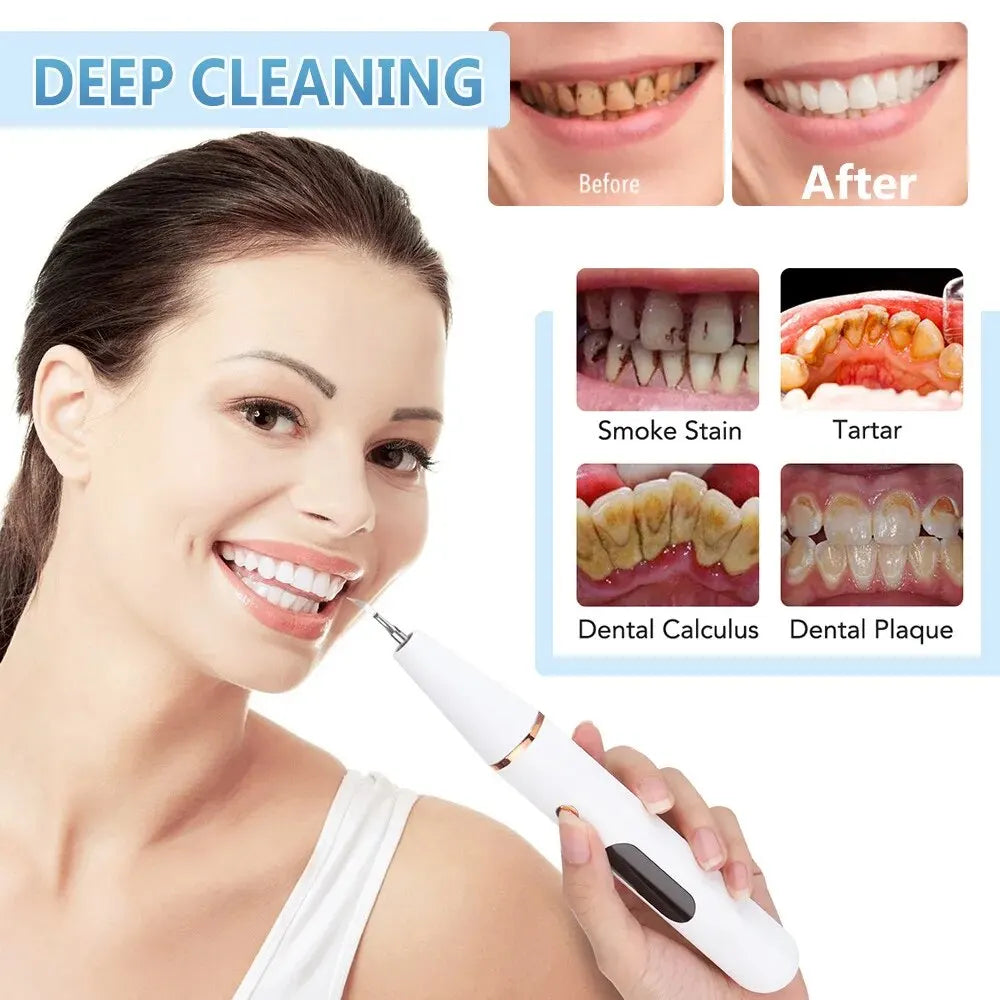 Pro Dental 38 kHz Ultrasonic Tooth Cleaner LED USB